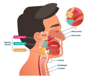 Skull-Base Surgery for Head and Neck Cancers