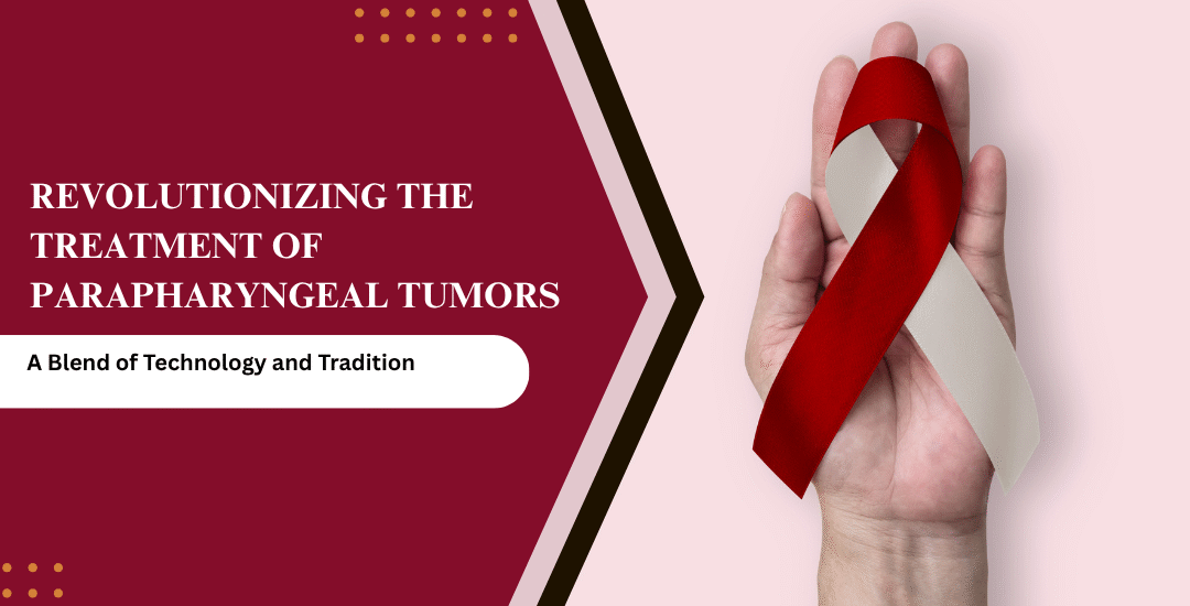 Revolutionizing the Treatment of Parapharyngeal Tumors