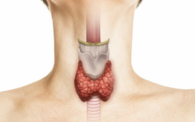 Scarless vs Normal Thyroid Surgery