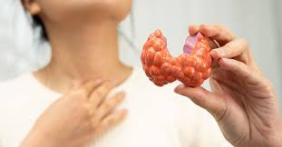 Who Can Get Scarless Thyroid Surgery?