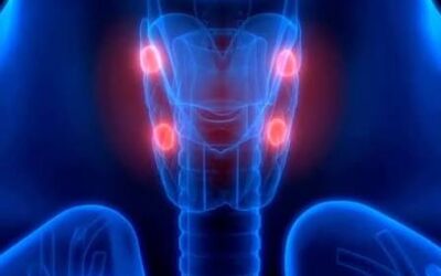  What Is Parathyroid Adenoma?