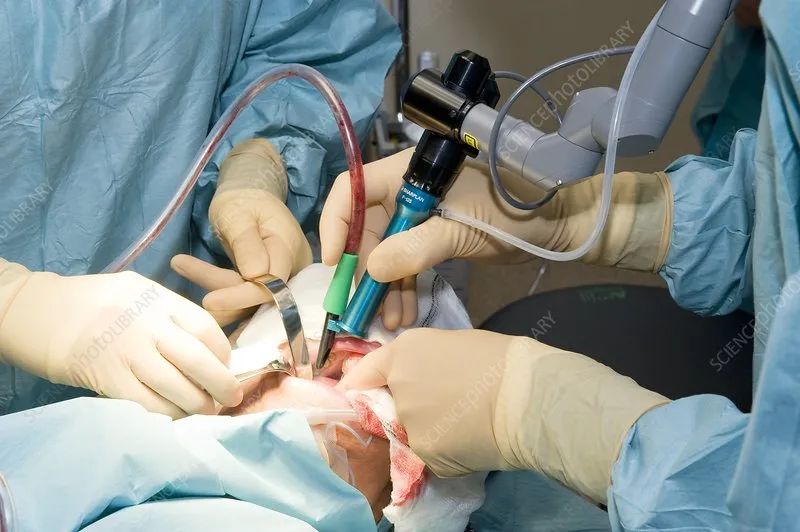 image5 | Head N Neck Surgery Surgeons perform a sterile operation using laparoscopic tools and a robotic instrument inside a patient.