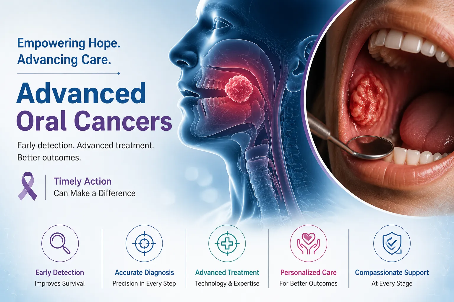 Promotional infographic about advanced oral cancers showing a profile head with a highlighted tumor and a close-up mouth exam in a circular frame on the right side.