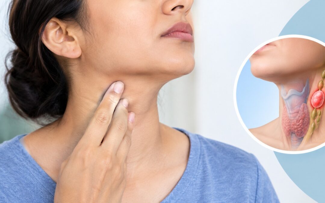 When Is a Neck Lump a Sign of Cancer?